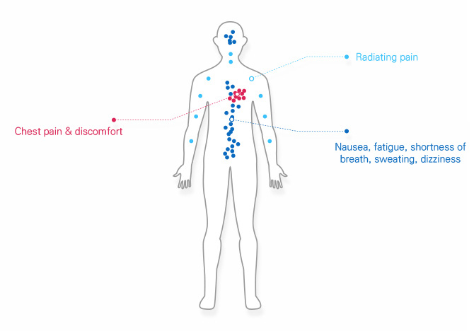 허혈성 심장질환 주요증상