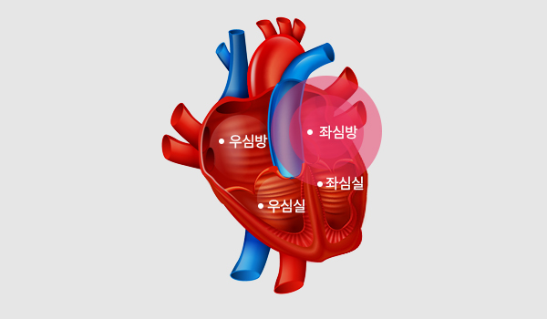 심장판막질환 이미지